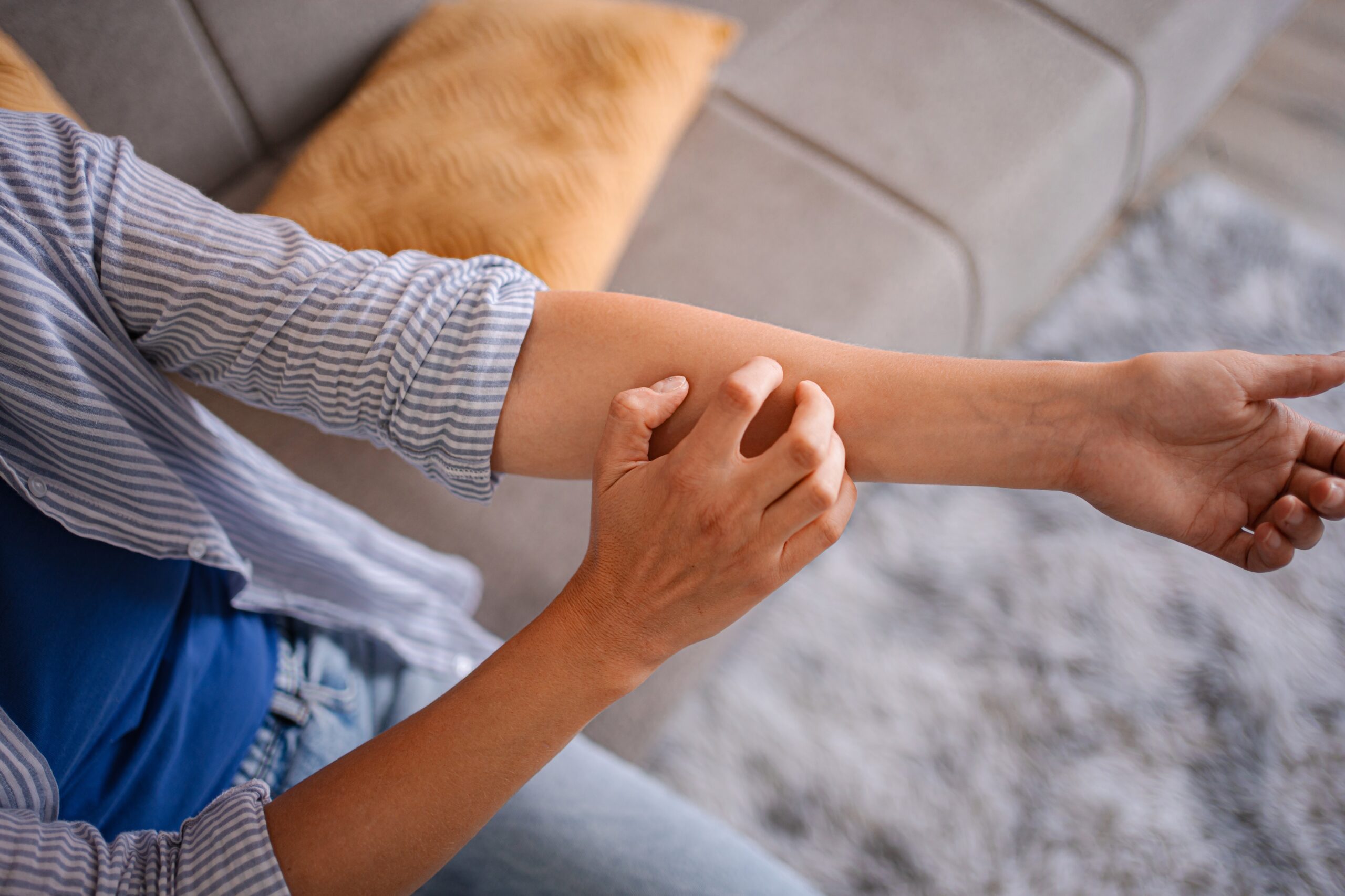 Skin Rashes Joint Pain and Wheat