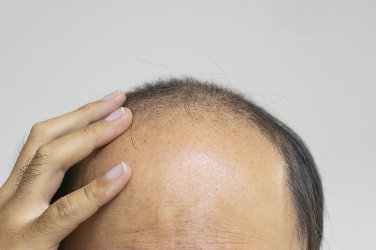 ghk-cu prolongs anagen phase hair growth Best Peptides for Hair Growth: GHK-Cu & Beyond (Doctor-Ranked 2026)