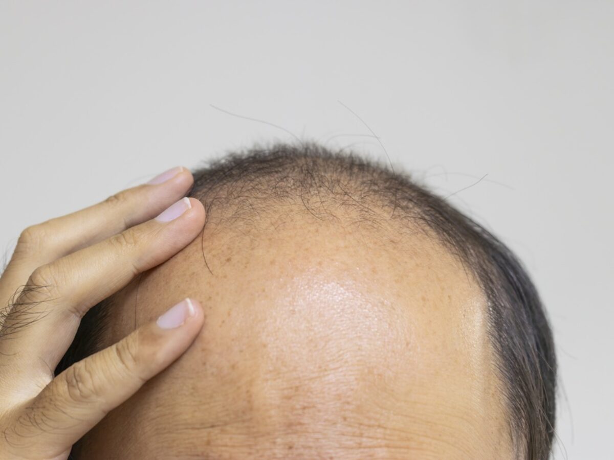 ghk-cu long-term use effectiveness tolerance Best Peptides for Hair Growth: GHK-Cu & Beyond (Doctor-Ranked 2026)
